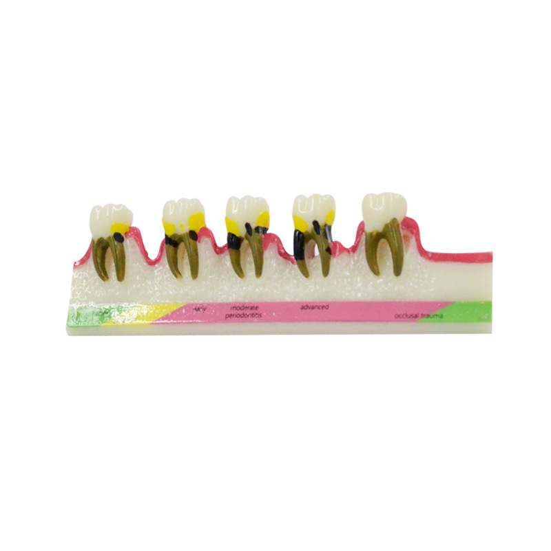 Periodontal Disease Model Dent - Medical Lab Study 评论和价格